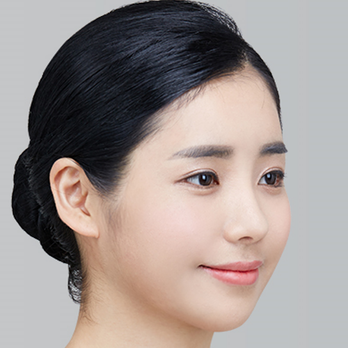 Nose Surgery
