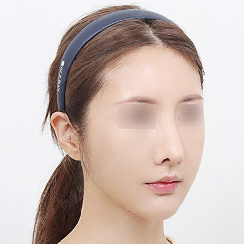Facial Contour Surgery
