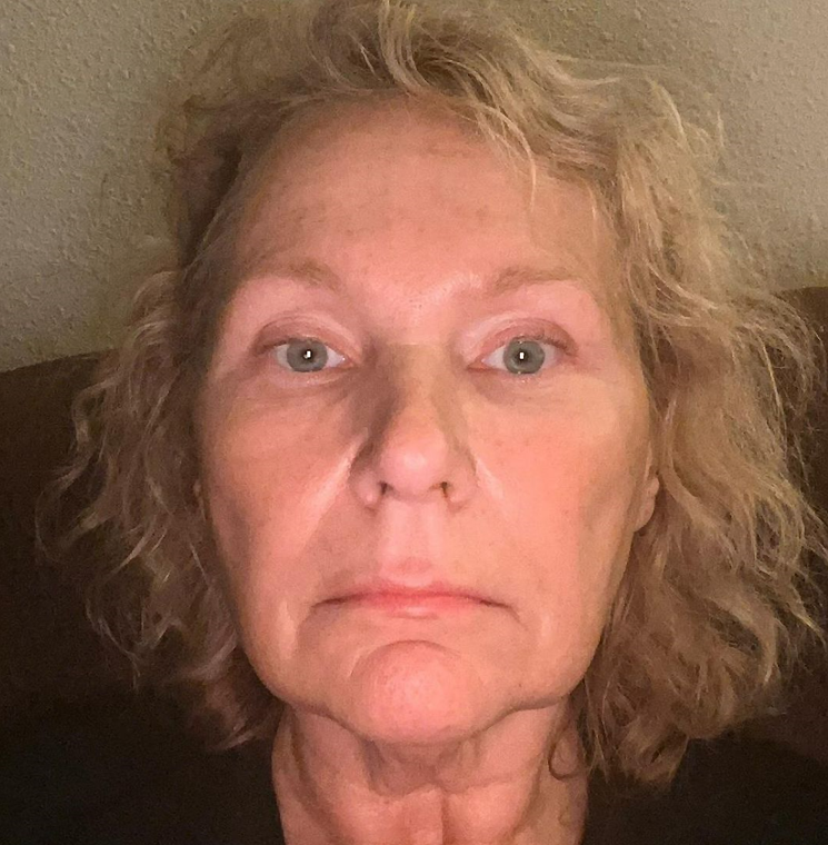 Before transformation